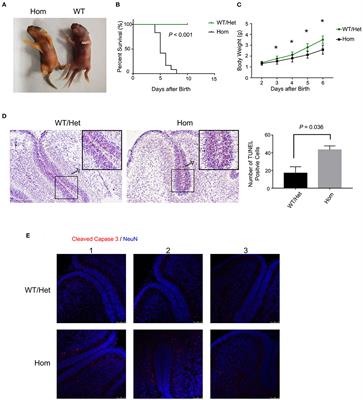 Pathological Significance and Prognostic Roles of Indirect Bilirubin/Albumin Ratio in Hepatic Encephalopathy